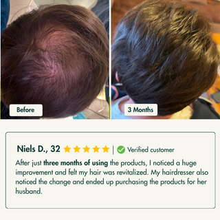 Hairline Recovery Serum